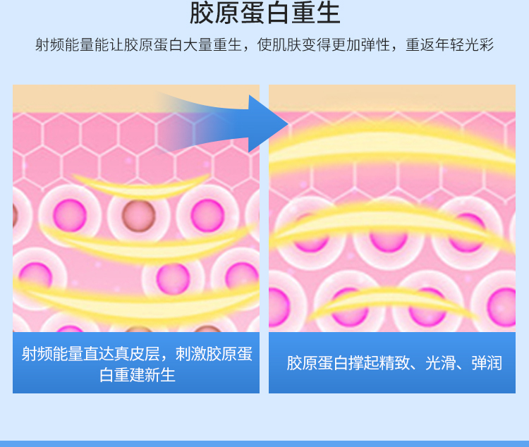 Japanese anti-sugar meter: -5